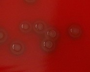 pneumococcus